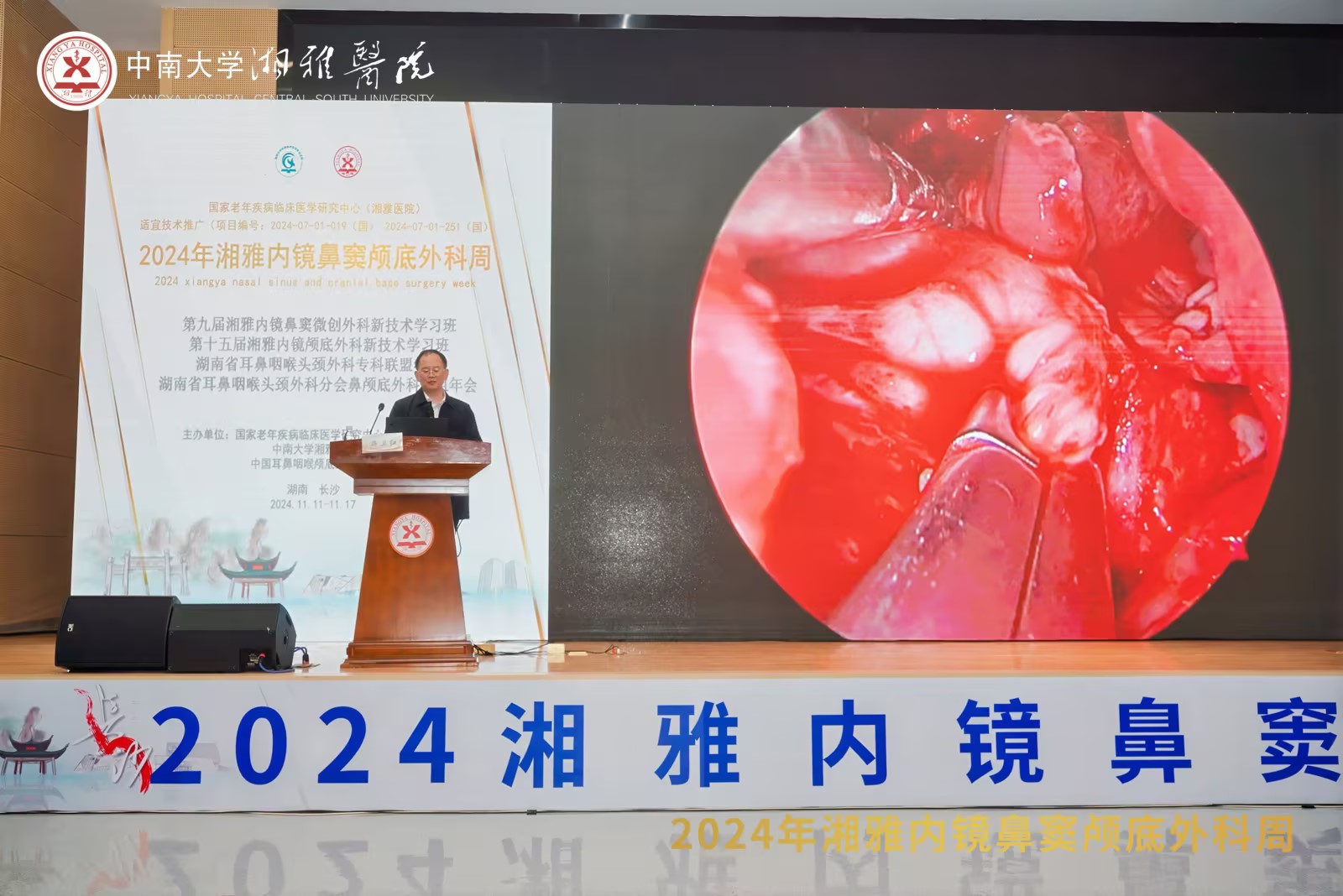 夹式双级、钨针术中应用亮相2024湘雅内镜鼻窦颅底外科周